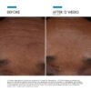 SkinCeuticals P-TIOX Peptide Anti-Wrinkle Serum 30ml | Advanced Anti-Aging Face Serum